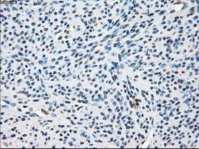 Immunohistochemistry: TTP Antibody (OTI8B5) - Azide and BSA Free [NBP2-74681] - Staining of paraffin-embedded Human endometrium tissue using anti-TTP mouse monoclonal antibody.