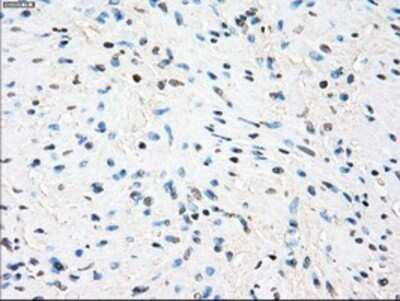 Immunohistochemistry: TTP Antibody (OTI8B5) - Azide and BSA Free [NBP2-74681] - Staining of paraffin-embedded Human prostate tissue using anti-TTP mouse monoclonal antibody.