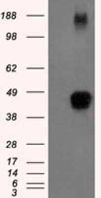 Western Blot: TTP Antibody (OTI8B5) - Azide and BSA Free [NBP2-74681] - HEK293T cells were transfected with the pCMV6-ENTRY control (Left lane) or pCMV6-ENTRY TTP (Right lane) cDNA for 48 hrs and lysed. Equivalent amounts of cell lysates (5 ug per lane) were separated by SDS-PAGE and immunoblotted with anti-TTP.