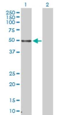 Western Blot: TTP Antibody [H00007538-D01P] - Analysis of ZFP36 expression in transfected 293T cell line by ZFP36 polyclonal antibody.Lane 1: ZFP36 transfected lysate(34.00 KDa).Lane 2: Non-transfected lysate.