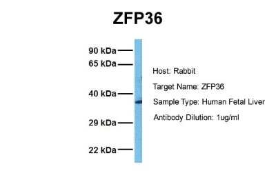 Western Blot: TTP Antibody [NBP2-86881] - Host: Rabbit. Target Name: ZFP36. Sample Tissue: Human Fetal Liver. Antibody Dilution: 1.0ug/ml