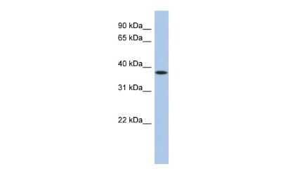 Western Blot: TTP Antibody [NBP2-86882] - WB Suggested Anti-ZFP36 Antibody Titration: 0.2-1 ug/ml. ELISA Titer: 1:312500. Positive Control: PANC1 cell lysateZFP36 is supported by BioGPS gene expression data to be expressed in PANC1