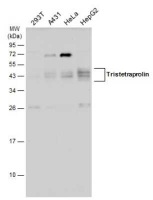 Western Blot: TTP Antibody [NBP3-12978] - Various whole cell extracts (30 ug) were separated by 12% SDS-PAGE, and the membrane was blotted with TTP antibody (NBP3-12978) diluted at 1:1000. The HRP-conjugated anti-rabbit IgG antibody (NBP2-19301) was used to detect the primary antibody, and the signal was developed with Trident ECL plus-Enhanced.