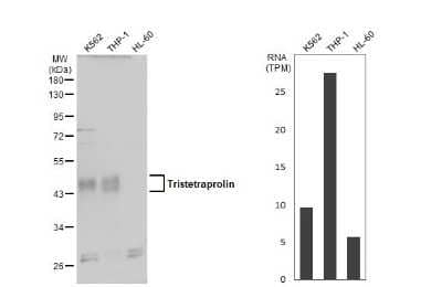 Western Blot: TTP Antibody [NBP3-12978] - Various whole cell extracts (30 ug) were separated by 10% SDS-PAGE, and the membrane was blotted with TTP antibody (NBP3-12978) diluted at 1:500. The HRP-conjugated anti-rabbit IgG antibody (NBP2-19301) was used to detect the primary antibody. Corresponding RNA expression data for the same cell lines are based on Human Protein Atlas program.