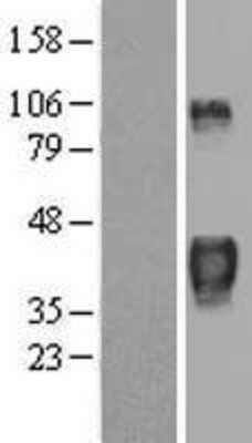 Western Blot: TTP Overexpression Lysate (Adult Normal) [NBL1-18018] Left-Empty vector transfected control cell lysate (HEK293 cell lysate); Right -Over-expression Lysate for TTP.