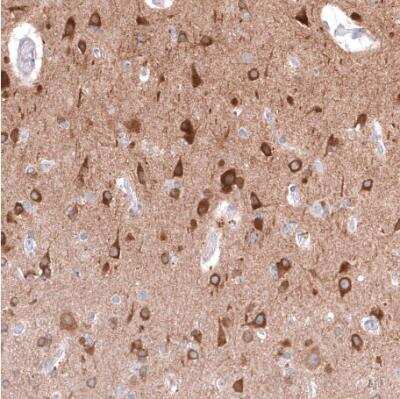 Immunohistochemistry-Paraffin: TTYH3 Antibody [NBP2-30621] - Staining of human cerebral cortex shows moderate cytoplasmic positivity in neurons.