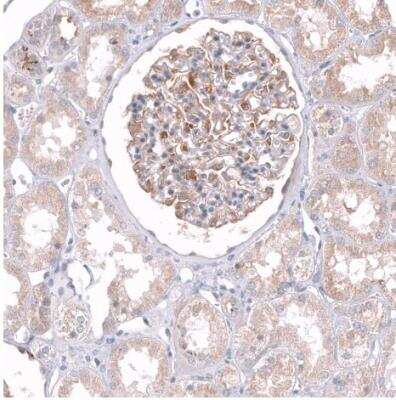 Immunohistochemistry-Paraffin: TTYH3 Antibody [NBP2-30621] - Staining of human kidney shows moderate cytoplasmic positivity in glomeruli and tubuli.