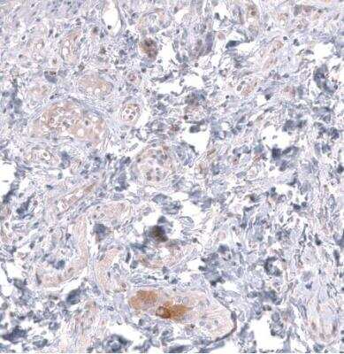 Immunohistochemistry-Paraffin: TTYH3 Antibody [NBP2-30621] - Staining of human rectum shows moderate cytoplasmic positivity in peripheral ganglion cells.