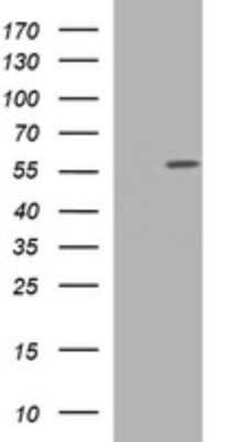Western Blot: TUBA6 Antibody (OTI1D8) - Azide and BSA Free [NBP2-74692] - Analysis of HEK293T cells were transfected with the pCMV6-ENTRY control (Left lane) or pCMV6-ENTRY TUBA6.