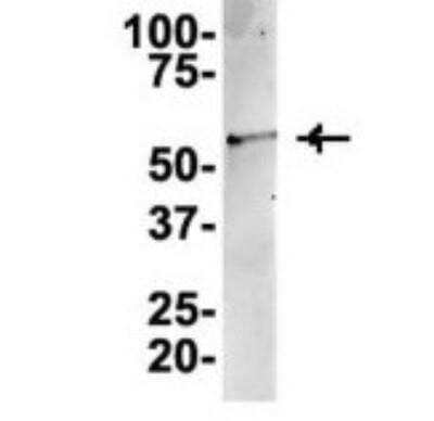 Western Blot TUBA6 Antibody - BSA Free