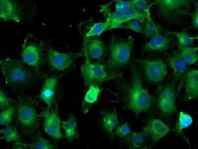 Immunocytochemistry/ Immunofluorescence TUBAL3 Antibody (OTI4C5)