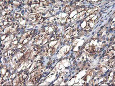 Immunohistochemistry-Paraffin TUBAL3 Antibody (OTI4C5)