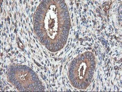 Immunohistochemistry-Paraffin TUBAL3 Antibody (OTI4C5)