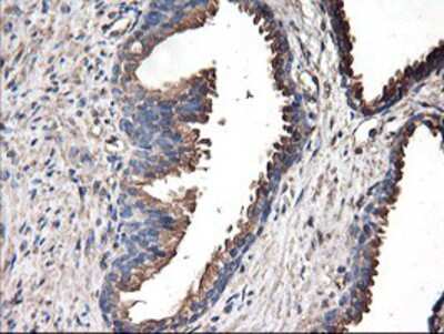 Immunohistochemistry-Paraffin TUBAL3 Antibody (OTI4C5)