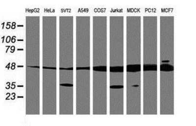 Western Blot TUBAL3 Antibody (OTI4C5)