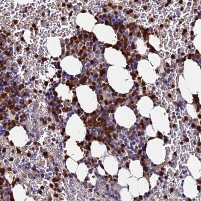 Immunohistochemistry-Paraffin TUBAL3 Antibody - BSA Free
