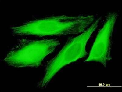 Immunocytochemistry/Immunofluorescence: TUBB4Q Antibody [H00056604-B01P] - Analysis of purified antibody to TUBB4Q on HeLa cell. (antibody concentration 10 ug/ml)