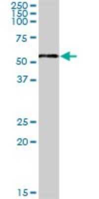 Western Blot: TUBB4Q Antibody [H00056604-B01P] - Analysis of TUBB4Q expression in human placenta.