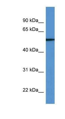 Western Blot: TUBB6 Antibody [NBP1-79815] - Human Placenta lysate, concentration 0.2-1 ug/ml.