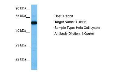 Western Blot TUBB6 Antibody - BSA Free