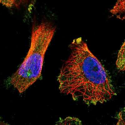 Immunocytochemistry/Immunofluorescence: TUBGCP5 Antibody [NBP2-55676] - Staining of human cell line U-251 MG shows localization to cytosol & centrosome.