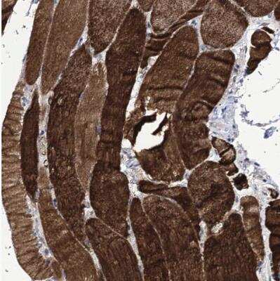 Immunohistochemistry-Paraffin: TUBGCP5 Antibody [NBP1-83380] - Staining of human skeletal muscle shows strong cytoplasmic positivity in myocytes.