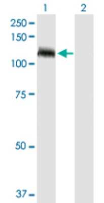 Western Blot: TUBGCP5 Antibody [H00114791-D01P] - Analysis of TUBGCP5 expression in transfected 293T cell line by TUBGCP5 polyclonal antibody.Lane 1: TUBGCP5 transfected lysate(118.20 KDa).Lane 2: Non-transfected lysate.