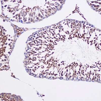 Immunohistochemistry-Paraffin: TUBGCP6 Antibody [NBP2-94428] - Immunohistochemistry of paraffin-embedded Rat testis using TUBGCP6 Rabbit pAb (NBP2-94428) at dilution of 1:100 (20x lens). Perform microwave antigen retrieval with 10 mM PBS buffer pH 7.2 before commencing with IHC staining protocol.