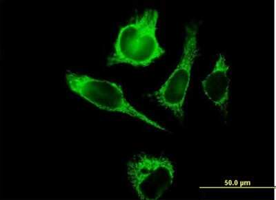 Immunocytochemistry/Immunofluorescence: TUFM Antibody [H00007284-B01P] - Analysis of purified antibody to TUFM on HeLa cell. (antibody concentration 10 ug/ml)