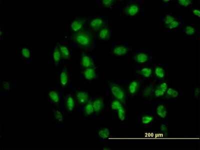 Immunocytochemistry/Immunofluorescence: TULP2 Antibody (2B5) [H00007288-M03] - Analysis of monoclonal antibody to TULP2 on HeLa cell. Antibody concentration 10 ug/ml