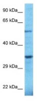 Western Blot: TULP2 Antibody [NBP3-10301] - Western blot analysis of TULP2 in OVCAR-3 Whole Cell lysates. Antibody dilution at 1.0ug/ml