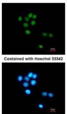 Immunocytochemistry/Immunofluorescence: TULP3 Antibody [NBP1-33201] -  Analysis of methanol-fixed HepG2, using TULP3 antibody at 1:200 dilution.