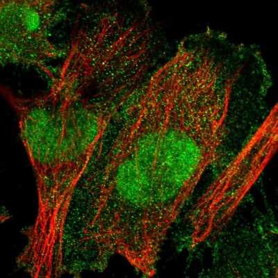 Immunocytochemistry/Immunofluorescence: TULP3 Antibody [NBP2-55375] - Staining of human cell line U-251 MG shows localization to nucleus, nucleoli & plasma membrane.