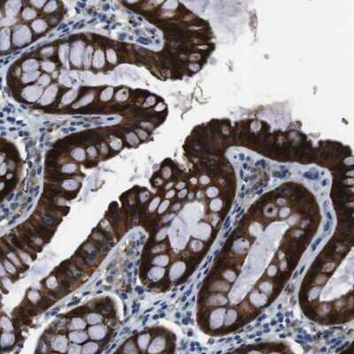 Immunohistochemistry-Paraffin: TULP3 Antibody [NBP1-86897] - Staining of human colon shows strong cytoplasmic positivity in glandular cells.