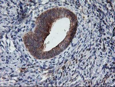 Immunohistochemistry: TULP3 Antibody (OTI7B8) - Azide and BSA Free [NBP2-74721] - Staining of paraffin-embedded Human endometrium tissue using anti-TULP3 mouse monoclonal antibody.