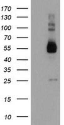Western Blot: TULP3 Antibody (OTI7B8) - Azide and BSA Free [NBP2-74721] - HEK293T cells were transfected with the pCMV6-ENTRY control (Left lane) or pCMV6-ENTRY TULP3 (Right lane) cDNA for 48 hrs and lysed. Equivalent amounts of cell lysates (5 ug per lane) were separated by SDS-PAGE and immunoblotted with anti-TULP3.