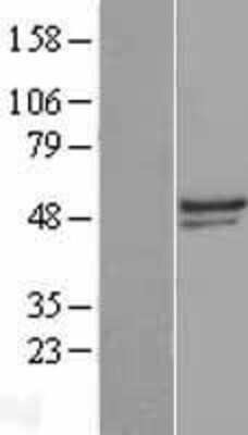 Western Blot TULP3 Overexpression Lysate