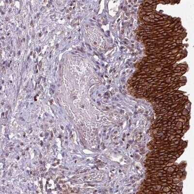 Immunohistochemistry-Paraffin: TUSC3 Antibody [NBP2-48952] - Staining of human urinary bladder shows strong cytoplasmic and membranous positivity in urothelial cells.