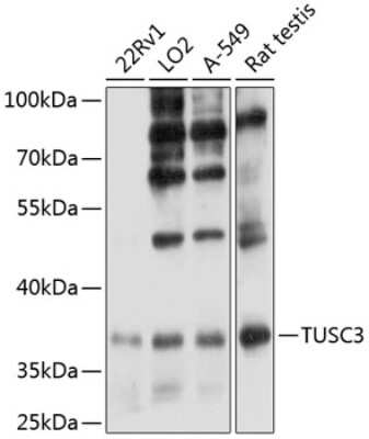 Western Blot: TUSC3 Antibody [NBP2-93249] - Analysis of extracts of various cell lines, using TUSC3 . Exposure time: 10s.