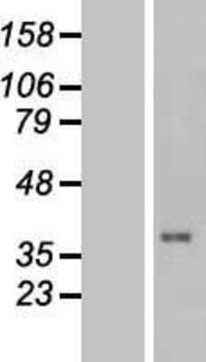 Western Blot: TUSC3 Overexpression Lysate (Adult Normal) [NBL1-17455] Left-Empty vector transfected control cell lysate (HEK293 cell lysate); Right -Over-expression Lysate for TUSC3.