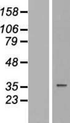 Western Blot: TUSC3 Overexpression Lysate (Adult Normal) [NBP2-09836] Left-Empty vector transfected control cell lysate (HEK293 cell lysate); Right -Over-expression Lysate for TUSC3.