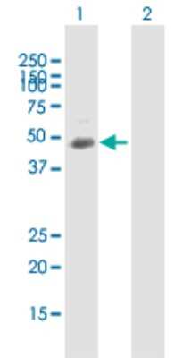 Western Blot: TUSC4 Antibody [H00010641-B02P] - Analysis of TUSC4 expression in transfected 293T cell line by TUSC4 polyclonal antibody.  Lane 1: TUSC4 transfected lysate(41.8 KDa). Lane 2: Non-transfected lysate.