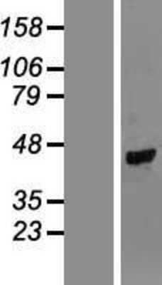 Western Blot TUSC4 Overexpression Lysate