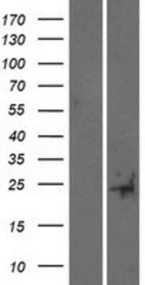 Western Blot: TUSC5 Overexpression Lysate (Adult Normal) [NBP2-05164] Left-Empty vector transfected control cell lysate (HEK293 cell lysate); Right -Over-expression Lysate for TUSC5.