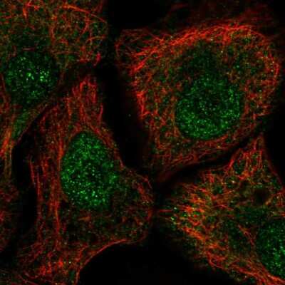 Immunocytochemistry/ Immunofluorescence TUT1 Antibody - BSA Free