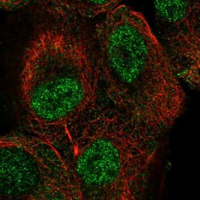 Immunocytochemistry/Immunofluorescence: TUT1 Antibody [NBP2-57861] - Staining of human cell line HaCaT shows localization to nucleus & cytosol. Antibody staining is shown in green. 