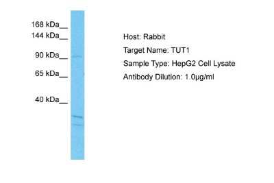 Western Blot TUT1 Antibody - BSA Free