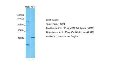 Western Blot TUT1 Antibody - BSA Free