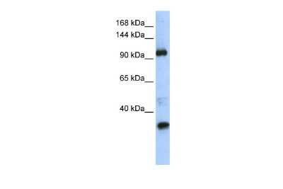Western Blot TUT1 Antibody - BSA Free
