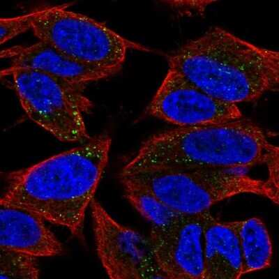 Immunocytochemistry/Immunofluorescence: TVP23A Antibody [NBP2-32556] - Staining of human cell line SH-SY5Y shows localization to vesicles. Antibody staining is shown in green.